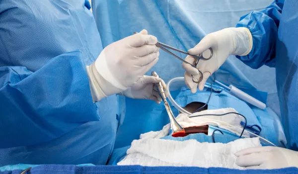 Surgical Tech in gloves passing an instrument to surgeon in the operating room.