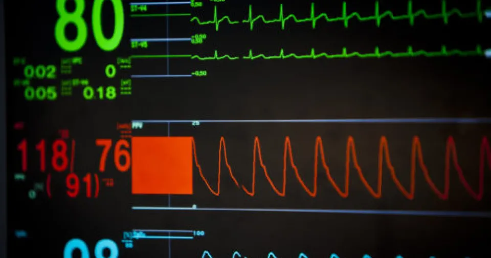 How does a vital signs monitor work? 